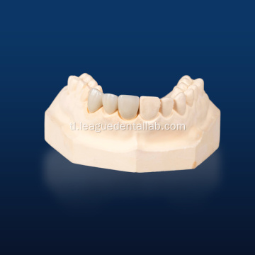 Dental Zirconia Porcelain Veneer